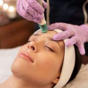 Service Microdermabrasion